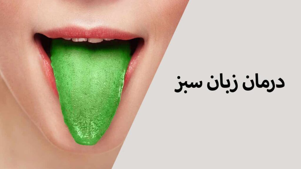 درمان زبان سبز