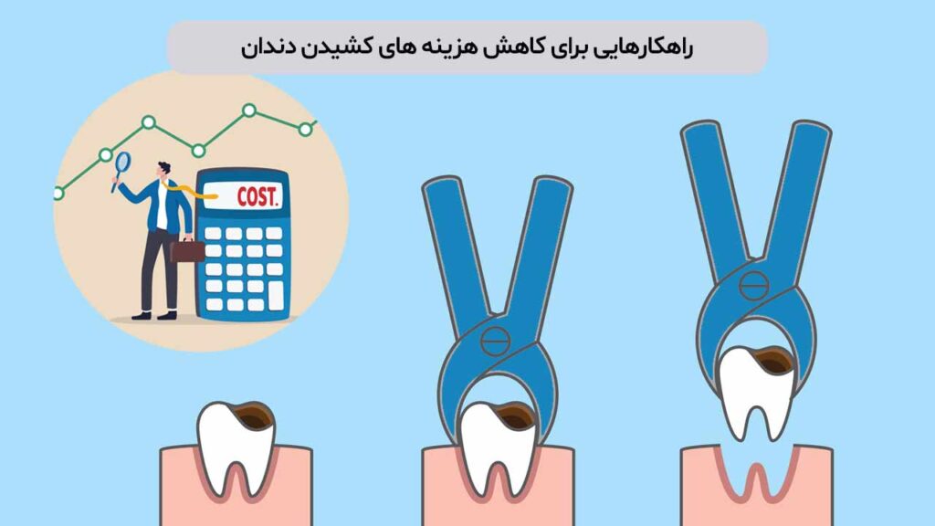 راهکارهایی برای کاهش هزینه های کشیدن دندان