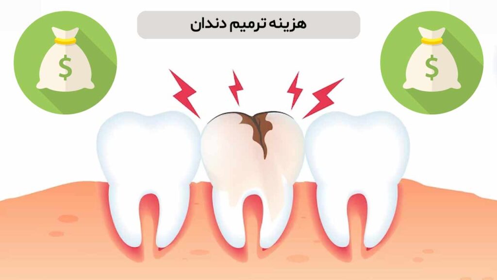 هزینه‌ ترمیم دندان