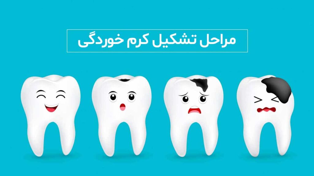 مراحل تشکیل کرم خوردگی