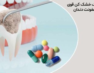 قرص چرک خشک کن قوی برای عفونت دندان